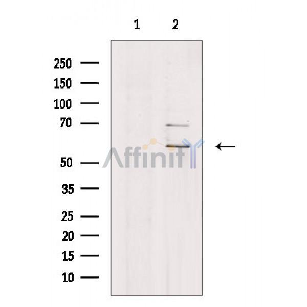Валидация Affinity DF9146 - 21489