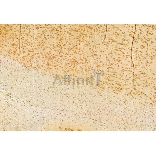 Валидация Affinity DF12011 - 6016