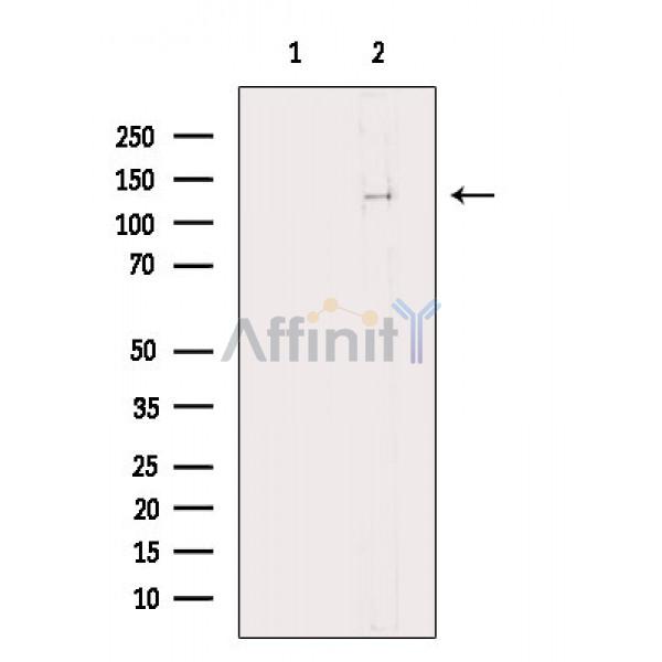Валидация Affinity DF6851 - 18425