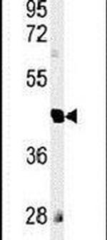 Валидация AssayVector ARM2187(3583)