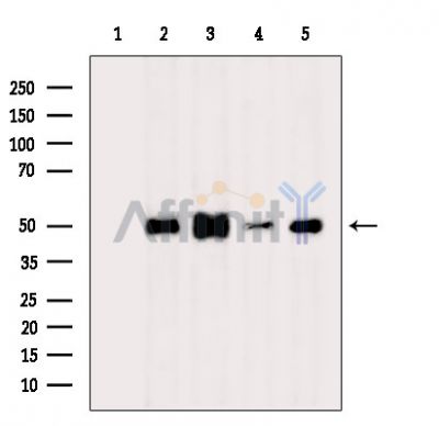 Валидация Affinity DF15031 - 11243