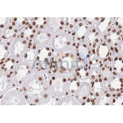 Валидация Affinity AF5260 - 2769