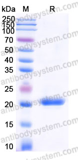 AHJ05901, SDS-PAGE