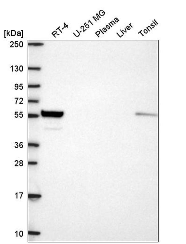 Валидация AssayVector ARM2427(4291)