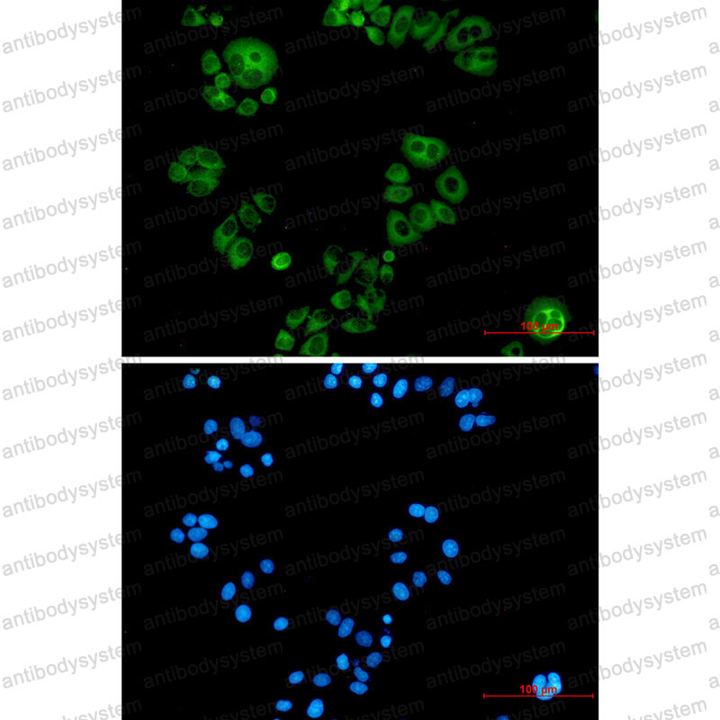 Валидация AntibodySystem RHC15301