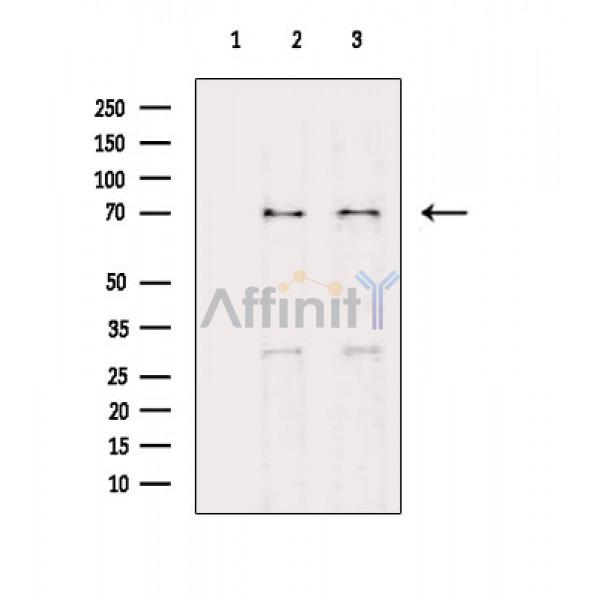 Валидация Affinity AF4091 - 2150