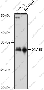 Вестерн-блоттинг, DNASE1, различные клеточные линии