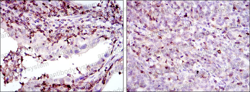 Валидация AntibodySystem RHD65702