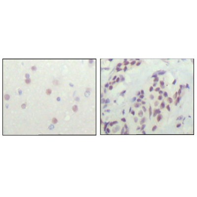 Валидация Affinity BF0701 - 5373