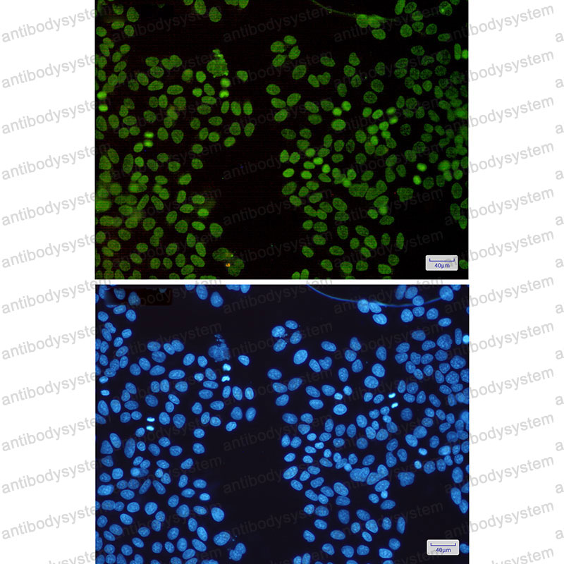 Валидация IF - AntibodySystem RHD22501
