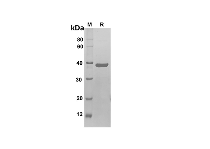 PDEH101115, электрофорез в ПААГ с ДСН
