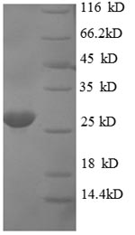SDS-PAGE
