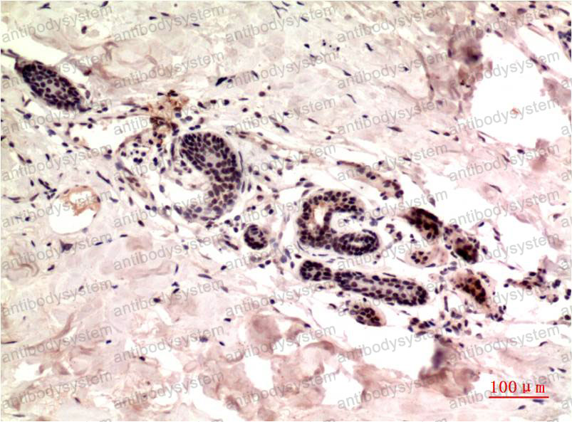 Валидация AntibodySystem RHD56204