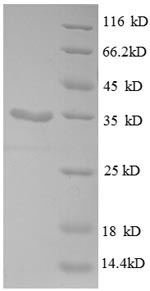 SDS-PAGE