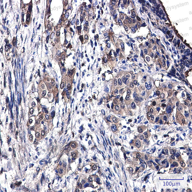 Валидация AntibodySystem RHC41403