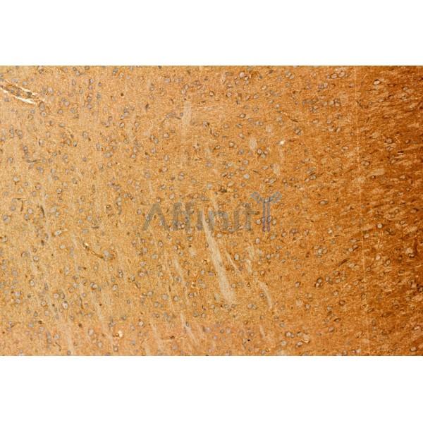 Валидация Affinity DF12095 - 6204