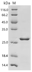 SDS-PAGE