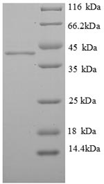 SDS-PAGE