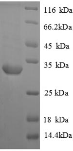 SDS-PAGE
