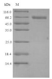 SDS-PAGE
