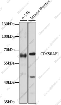 Вестерн-блоттинг, CDK5RAP1, различные клеточные линии