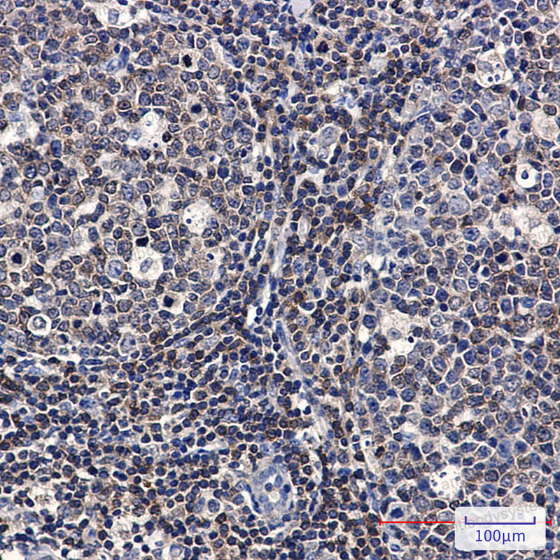 Валидация AntibodySystem RHG77401