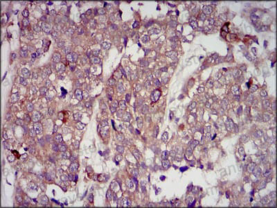 Валидация AntibodySystem RHB94102