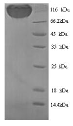 SDS-PAGE