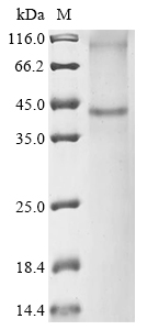 SDS-PAGE