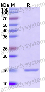 YXX50701, SDS-PAGE