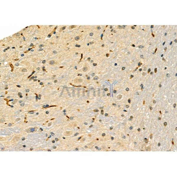 Валидация Affinity DF6585 - 18026