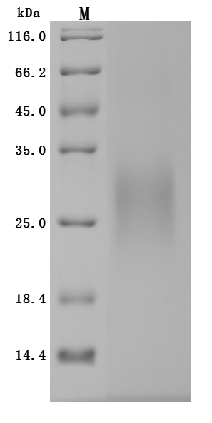 SDS-PAGE