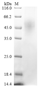 SDS-PAGE