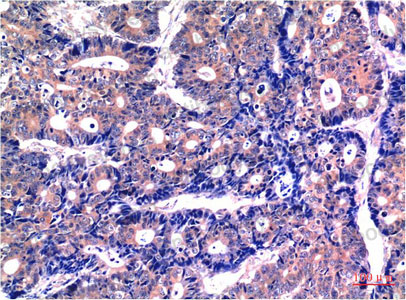 Валидация AntibodySystem RHE72106