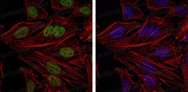 Валидация IF - AntibodySystem RHE07802