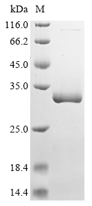 SDS-PAGE