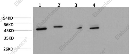 Вестерн-блоттинг, gamma Tubulin, клетки Jurkat, HeLa, ткань мозга мыши и крысы
