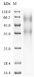 SDS-PAGE