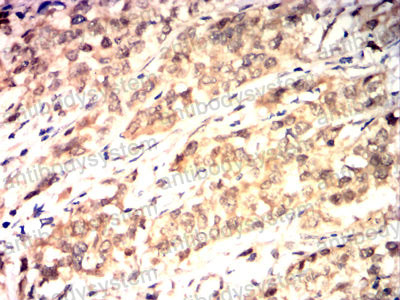 Валидация AntibodySystem RHE05804 (1940)