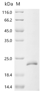 SDS-PAGE