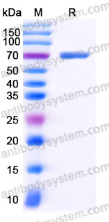 YHK05702, SDS-PAGE