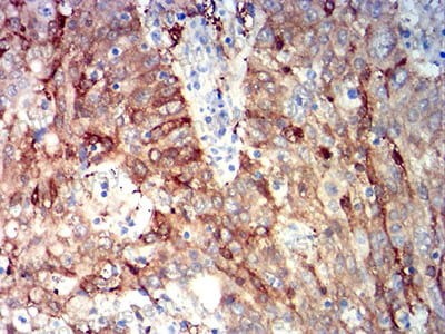 Валидация AntibodySystem RHB85102