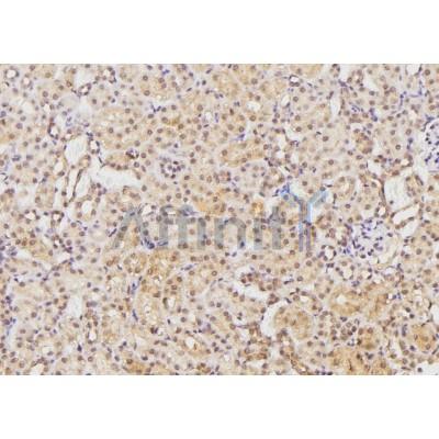 Валидация Affinity AF6343 - 3623