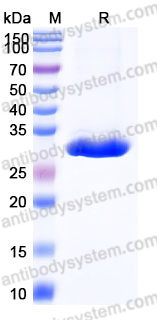 EHJ92902, SDS-PAGE