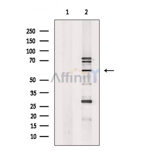 Валидация Affinity DF3193 - 14009