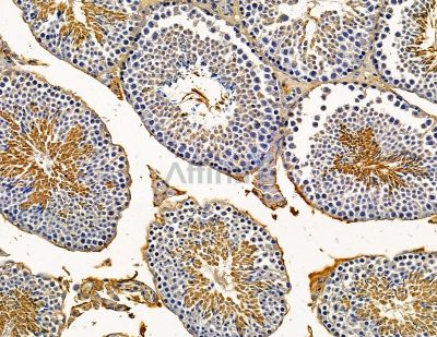 Валидация Affinity DF14984 - 11188