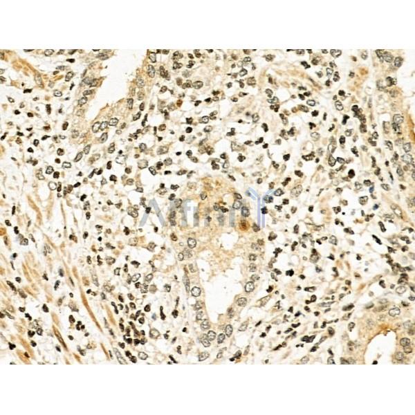 Валидация Affinity DF2217 - 12746