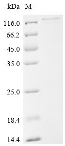 SDS-PAGE