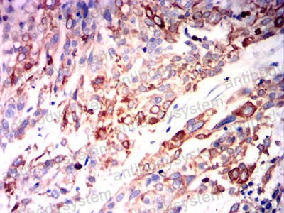 Валидация AntibodySystem RHC23301 (801)