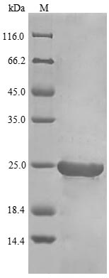SDS-PAGE